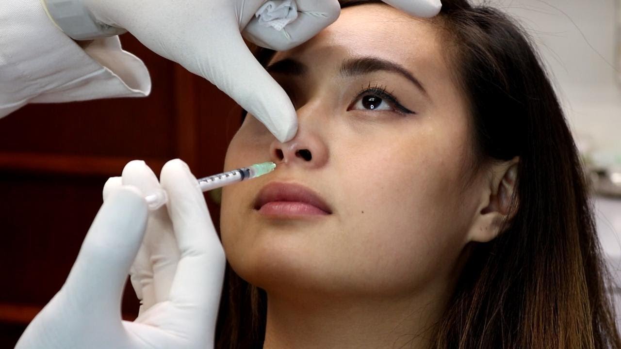 Cách giảm sưng bầm sau nâng mũi nhanh chóng và hiệu quả 15 Nose Lift without Surgery?!