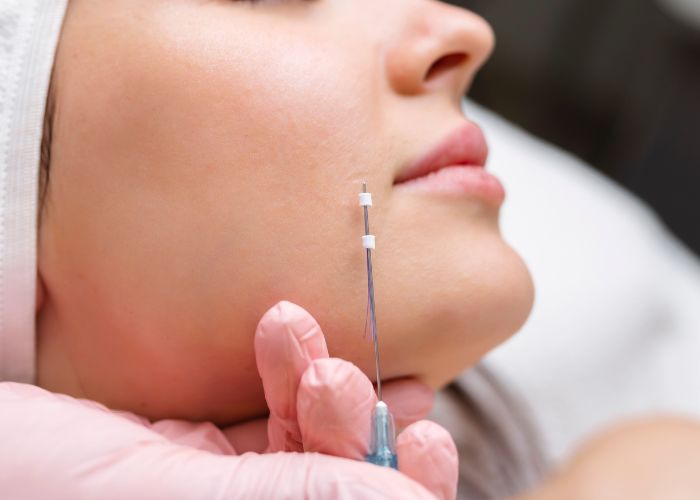 Nâng mũi bán cấu trúc sửa được mũi hỏng không, tư vấn 15 Nose Thread Lift summary of five things | Face Lift | PpeumGlobal