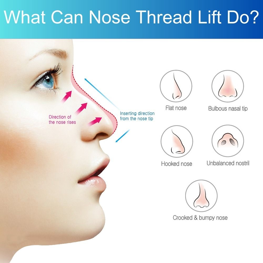 Nâng mũi bao lâu được trang điểm, tư vấn từ chuyên gia 17 Thread Lift Malaysia - Effective Non-Surgical Thread Lifting