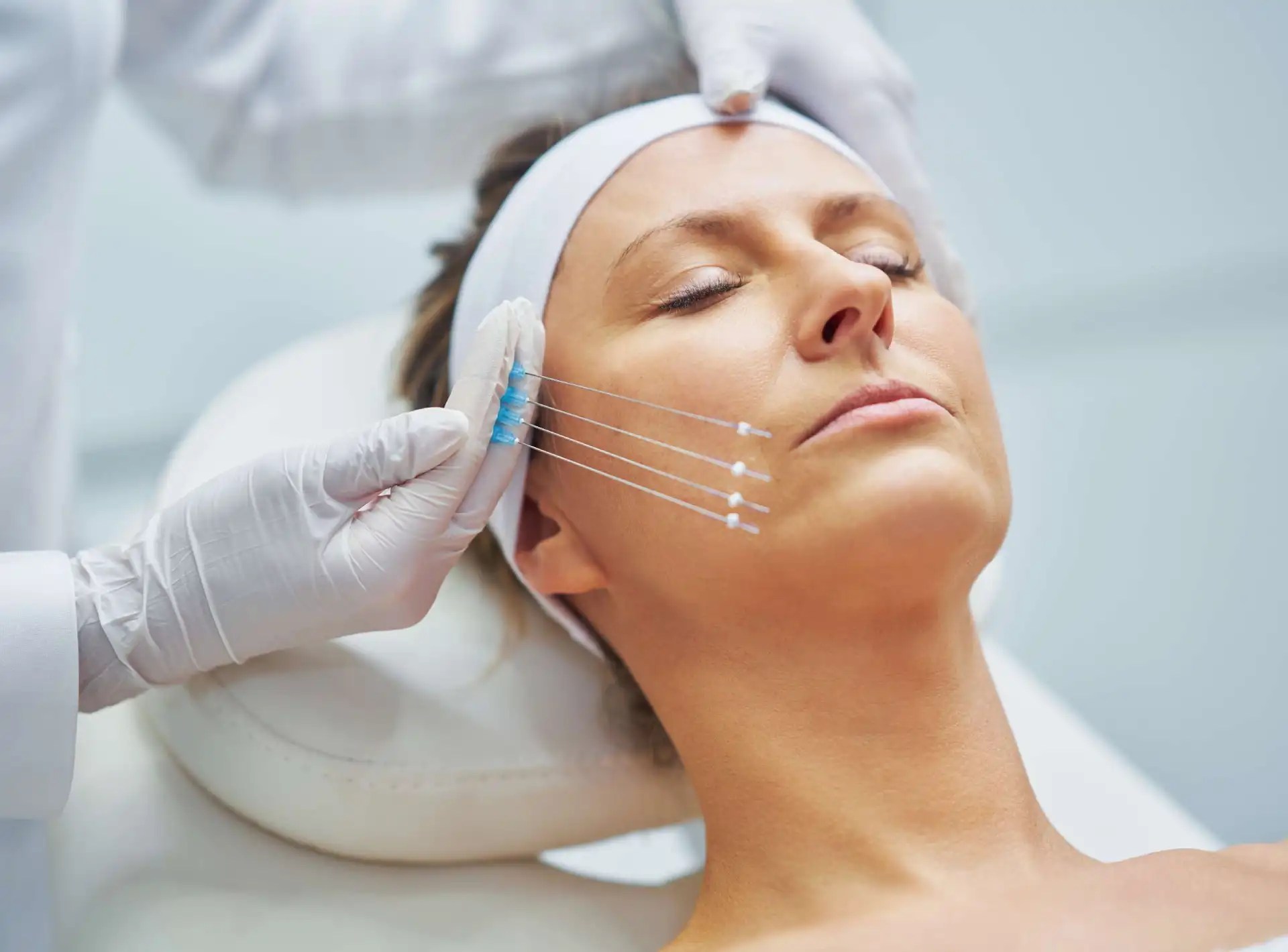 Nâng mũi kiêng ăn gì, chế độ dinh dưỡng giúp nhanh lành 14 Hiko Nose Lift Threads Vs Fillers | Perfect Doctors Clinic