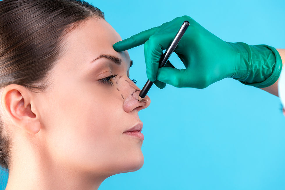 Nâng mũi S-Line sụn tự thân và nhân tạo cho dáng mũi đẹp 9 Rhinoplasty vs Nose Thread Lift: Which Gives Better Results?
